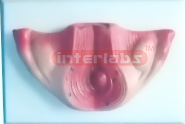 UTERUS WITH EMBRYO (1 MONTH)